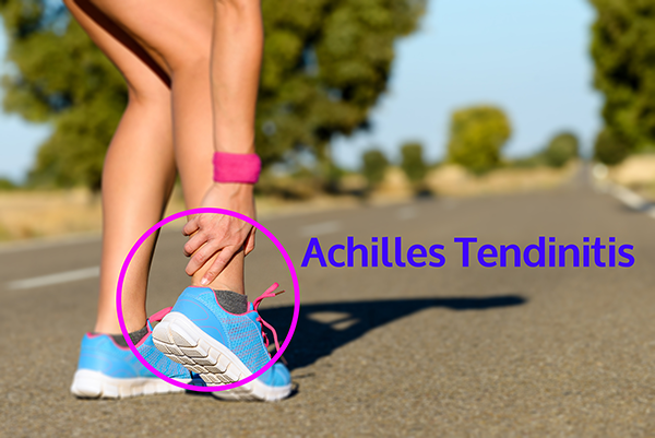 Achilles Tendinitis